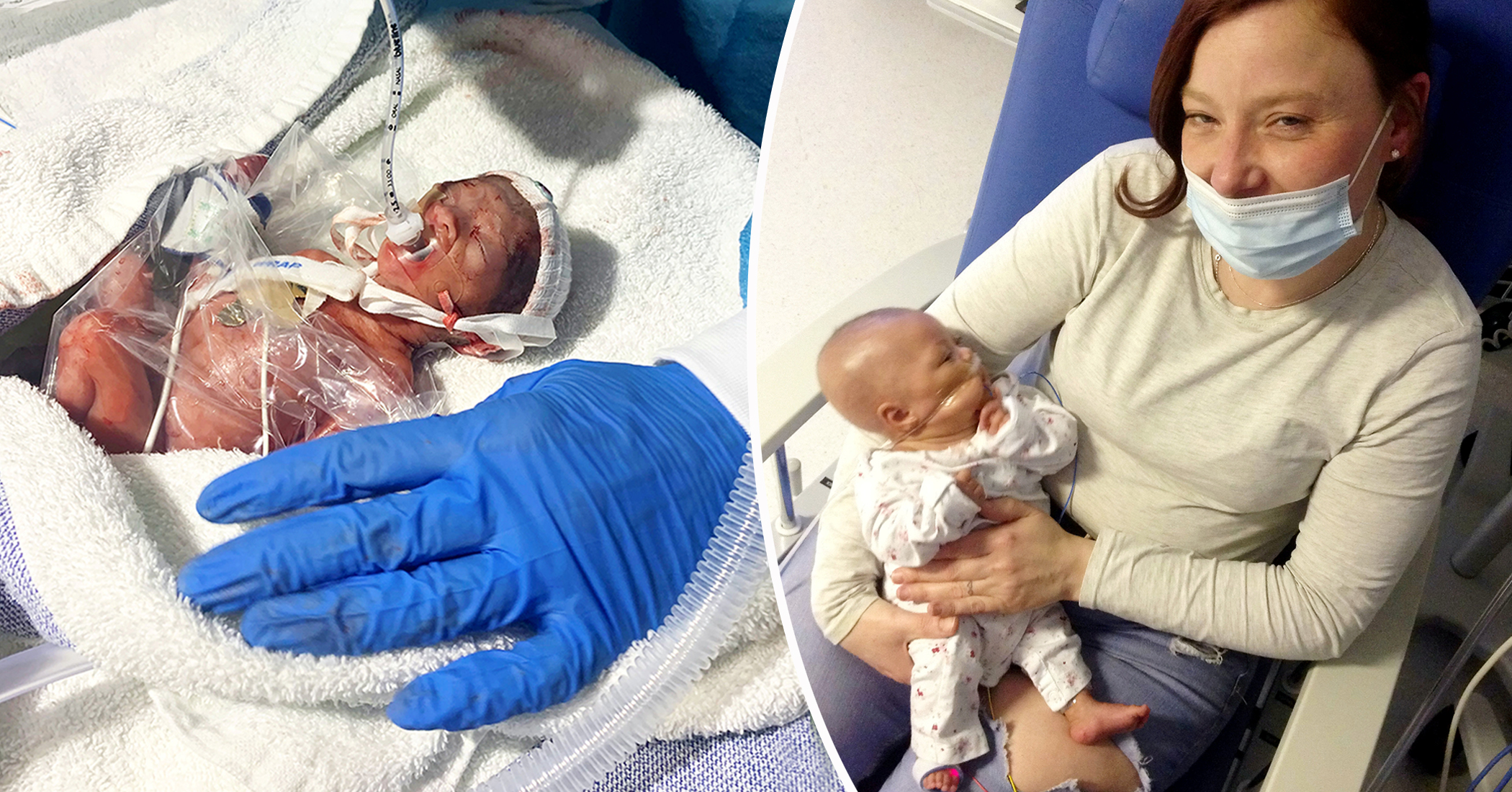 One Of Britains Most Premature Babies Born At Just Weeks Defies