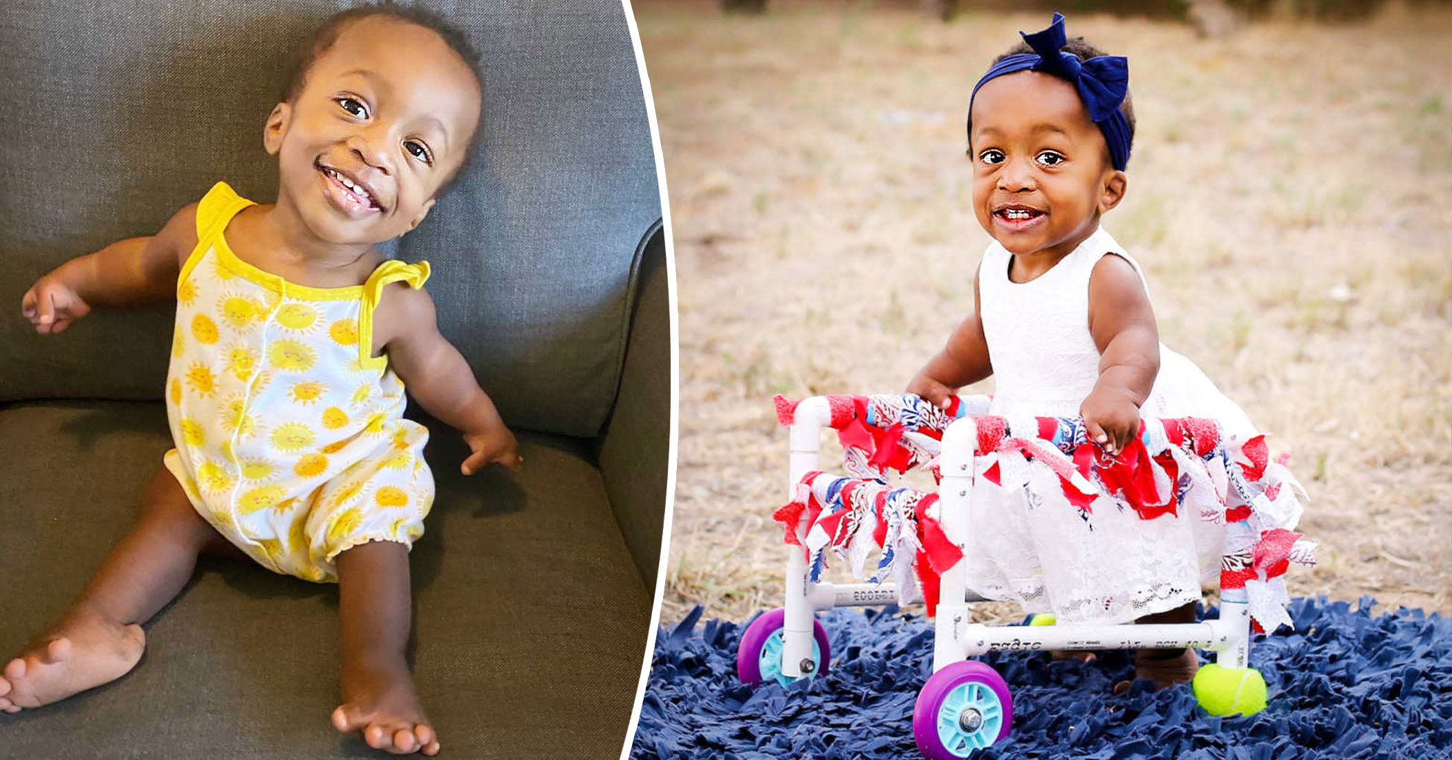Parents Bring Home Baby With Dwarfism, Deformed Limbs, Help Her Thrive ...